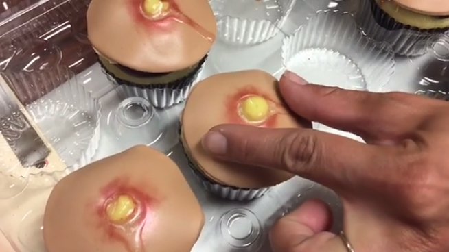 Pimple Cupcakes… Yum?